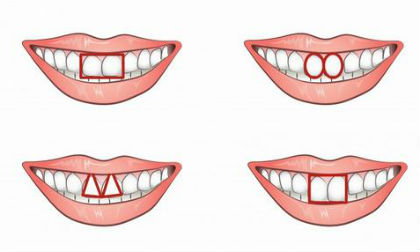 Nhìn răng cửa đoán chính xác tính cách của bạn