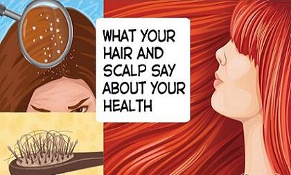 Đoán bệnh cơ thể qua biểu hiện bất thường của tóc cực chuẩn