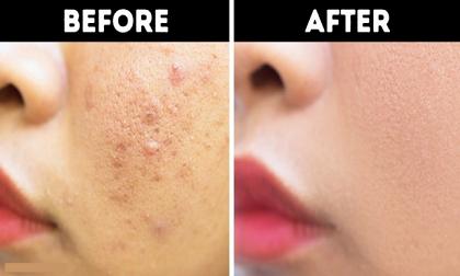 Đừng nằm ườn ra đấy mà mơ da trắng tóc đẹp, hãy đứng lên thử ngay những công thức này đi!