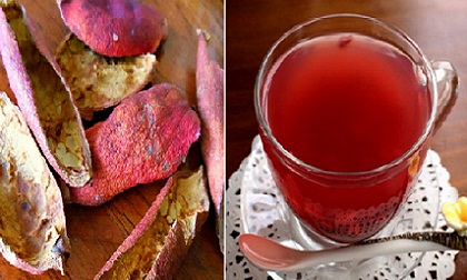 Chẳng còn lo loét dạ dày với bài thuốc của người Nga chỉ 7 ngày là khỏi