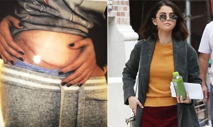 Selena Gomez lần đầu xuất hiện sau khi tiết lộ chuyện ghép thận