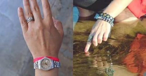 Đeo vòng và đồng hồ tay trái có thể gây teo cơ