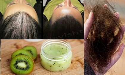 Vào thu rồi, bạn sẽ không bao giờ rụng tóc khi sử dụng hỗn hợp này 1 lần/ tuần