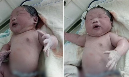 Vĩnh Phúc: Bé trai chào đời nặng kỷ lục 7,1kg 