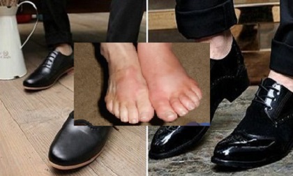 Đừng đi giày mà không đi tất vì nó nguy hiểm hơn bạn nghĩ