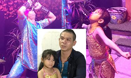 Rớt nước mắt trước hoàn cảnh của diễn viên xiếc nhập viện hơn 200 lần, phải nhờ bạn nuôi con nhỏ nếu chết trên sân khấu