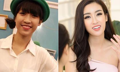 Hoa hậu Đỗ Mỹ Linh âm thầm bọc răng sứ trước khi dự thi Miss World?