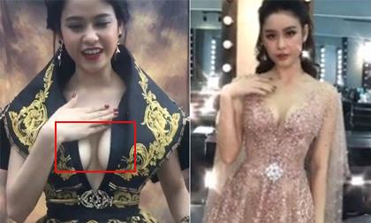 Trương Quỳnh Anh bị lộ nhược điểm khi dân mạng khơi lại ảnh cũ so sánh với ảnh mới sau phẫu thuật