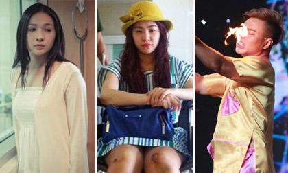 Những sao Việt sơ suất bị bỏng dẫn đến đau đớn và hoảng loạn