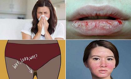 15 vấn đề cực đau đầu mà phụ nữ gặp phải vào mùa đông, cái số 7 xấu hổ muốn chết