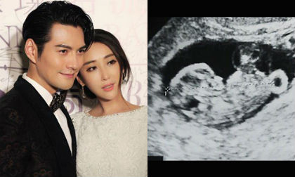 Sao 'Thần điêu đại hiệp' Nghiêm Khoan chuẩn bị lên chức bố