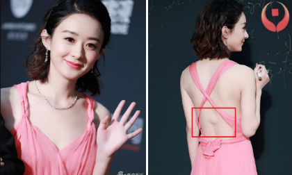 Triệu Lệ Dĩnh lộ vết sẹo lớn khi diện đầm hở lưng