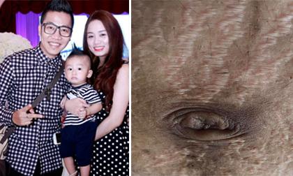 Hoàng Rapper rơi nước mắt: Bụng vợ tôi sau sinh nứt nẻ, bấy nhầy, tan nát