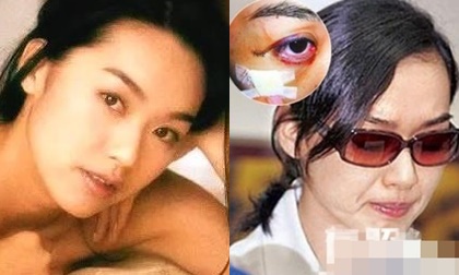 Chân dài xứ Đài chảnh chọe và cái kết đắng: Sắp lên bàn đẻ vẫn bị chồng đánh