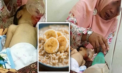 Trẻ sơ sinh tử vong vì bà cho ăn dặm quá sớm và lời cảnh tỉnh cho các bậc phụ huynh