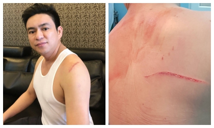 Bác sĩ thẩm mĩ Chiêm Quốc Thái bị truy sát ở trung tâm TP.HCM