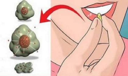 Top 5 thực phẩm ức chế tế bào ung thư hàng đầu được chuyên gia khuyên dùng