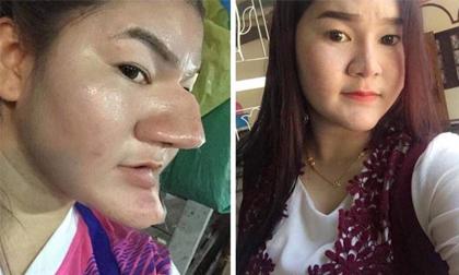 Nhìn ảnh tưởng cô gái phẫu thuật hỏng nhưng sự thật đằng sau khiến nhiều người 'ngã ngửa'