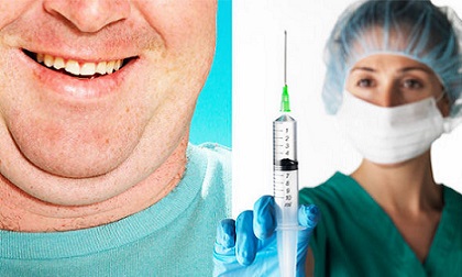 Chẳng cần nhịn ăn hay thể dục mà vẫn giảm cân thần tốc chỉ với một mũi tiêm