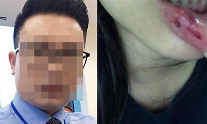 Vụ BTV Minh Tiệp bị nghi bạo hành em vợ: Bố của nữ sinh 15 tuổi lên tiếng 