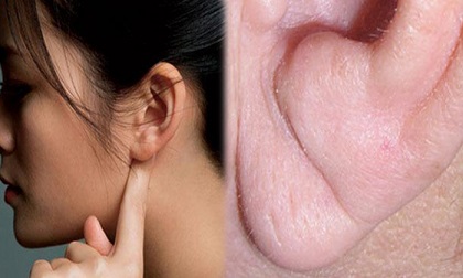 Nếu bạn 35 tuổi, có bất kỳ 'nếp gấp' nào xuất hiện trên tai thì phải tới bệnh viện kiểm tra ngay lập tức