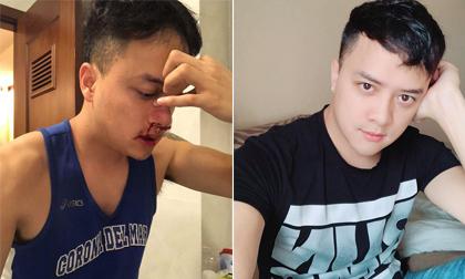 Cao Thái Sơn chia sẻ tình hình sức khỏe sau ca phẫu thuật tưởng như 'chết đi sống lại'