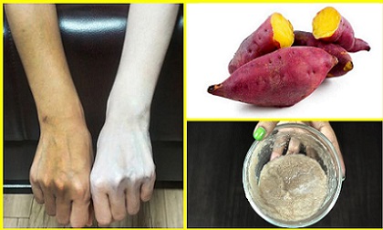 Cứ dùng những mặt nạ dưỡng trắng từ khoai lang dưới đây, da lên tone hơn cả Ngọc Trinh