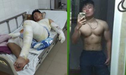 Từng bị bỏng nặng 40%, chàng trai Thái Nguyên lấy lại body sáu múi đáng ghen tị