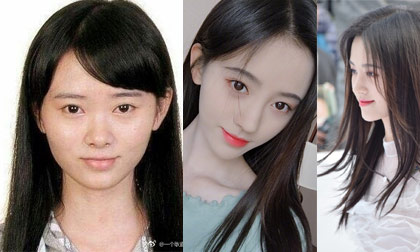 'Mỹ nữ 4000 năm có một' của Trung Quốc lộ nhan sắc 'một trời một vực' khi chưa thẩm mỹ