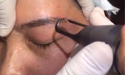 Một đôi lông mày hỏng, việc đầu tiên phải làm gì?