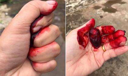 Cô vợ dùng chiêu độc lạ dọa chồng ngất xỉu, thế nhưng đây mới là thứ được dân mạng quan tâm