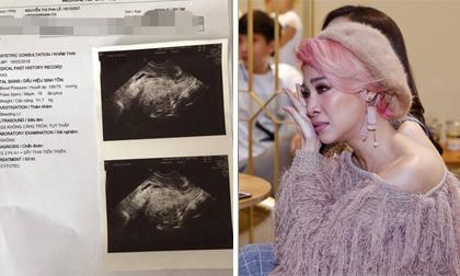 Pha Lê tiết lộ từng có thai nhưng chỉ 1 tuần sau khi biết tin vui lại bị sảy