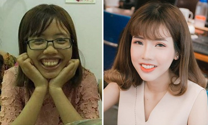 Hành trình 'vịt hóa thiên nga' của cô gái bị đuổi việc vì quá xấu gây 'sốt mạng'