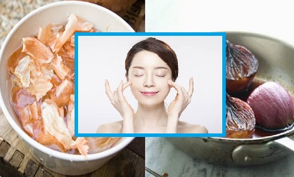 Dùng hành tây theo cách này, cân nặng giảm vù vù, hết sạch tàn nhang và chống lão hóa