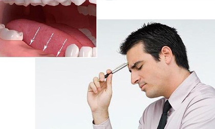 Trồng răng hàm vĩnh viễn bằng loại nào tốt nhất? 