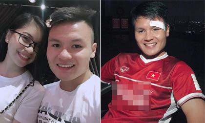 Bị rách mắt ứa máu sau trận thắng Olympic Syria, Quang Hải tiết lộ tình hình sức khỏe hiện tại 