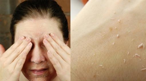 10 năm sau làn da vẫn mềm mịn, không nếp nhăn nếu áp dụng ngay kế hoạch chăm sóc này