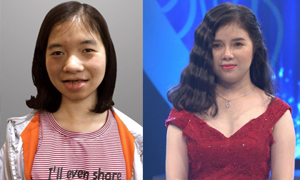 Hành trình 'lột xác' ngỡ ngàng của cô gái bị gắn mác 'ma cà rồng' suốt 18 năm không dám soi gương