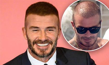 David Beckham khoe diện mạo mới sau tin đồn trải qua cuộc cấy ghép tóc bí mật