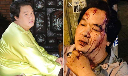 Trước khi gặp tai nạn nghiêm trọng, Hoàng Mập nhiều lần nằm mơ điều đáng sợ