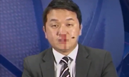 Máu mũi chảy ròng ròng, BTV thể thao vẫn bình tĩnh dẫn chương trình như không có gì xảy ra