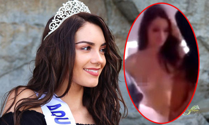 Người đẹp 20 tuổi bị lộ ngực trên sóng trực tiếp gây bức xúc dư luận