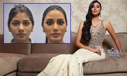 Lộ ảnh thời chưa nâng mũi, độn cằm của Á hậu Hoàn vũ 2018, dân mạng kêu trời vì quá bất công cho H'Hen Niê