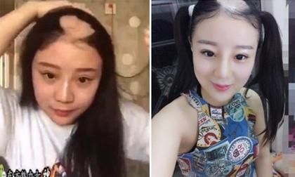 Cuộc sống hiện tại của 'mỹ nữ bị hói đầu vì ăn ngô bằng máy khoan' khiến nhiều người bất ngờ