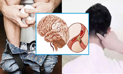 Đột ngột quay người lại, đại tiện quá nhanh... là những hành động dễ khiến đứt mạch máu não