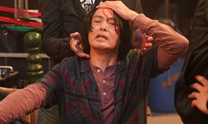 Châu Nhuận Phát gặp tai nạn chảy máu đầu tung toé giữa phim trường khi đóng cảnh hành động