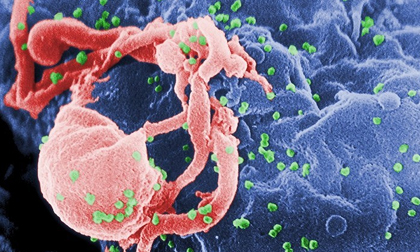Thêm bệnh nhân thứ 3 chữa khỏi HIV