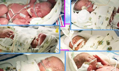 Kỳ diệu bà mẹ thụ thai tự nhiên, sinh 6 con vỏn vẹn chỉ trong 9 phút