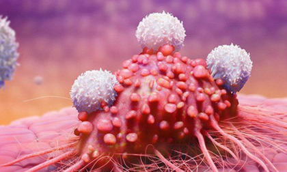 8 dấu hiệu 'tiền ung thư', cảnh báo cơ thể đang đi đến cực hạn