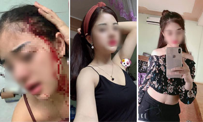 Sở hữu nhan sắc xinh đẹp, cô gái trẻ vẫn bị chồng vũ phu hành hạ đến bầm dập, tơi tả